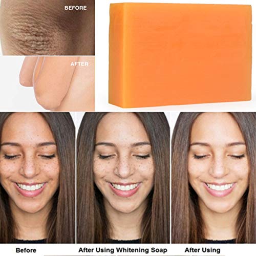 Peak Health Kojie San Face Soap – Acne Prone - Lightening Bar - Smoothing Away - Dark Spots – Discoloration - Heals Acne Blemishes - Erases Red Marks and Scars – Philippines - Pack of 1 - 135 grams