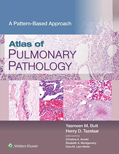 Atlas of Pulmonary Pathology: A Pattern Based Approach (English Edition)