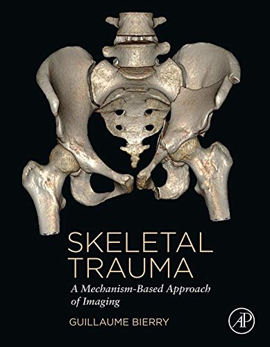 Skeletal Trauma: A Mechanism-Based Approach of Imaging (English Edition)