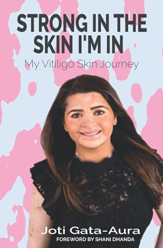 Strong In the Skin I'm In: My Vitiligo Skin Journey