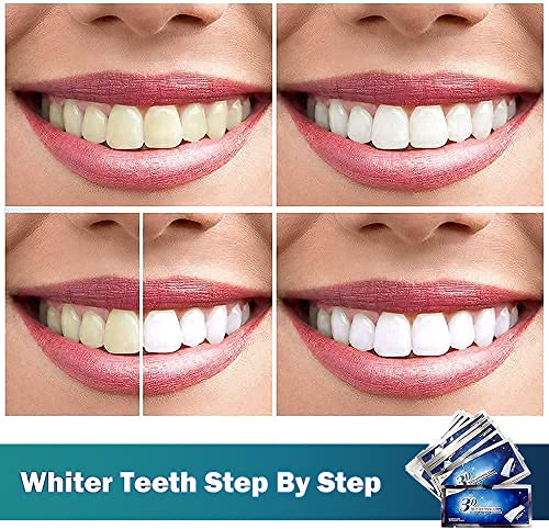 Blanqueador Dental, 14 Tiras Blanqueadoras Dientes,Teeth Whitening Strips,Reduce Sensibilidad Dental,Eliminación Profesional de manchas de dientes