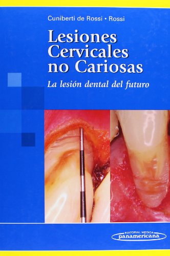 Lesiones cervicales no cariosas: La lesión dental del futuro