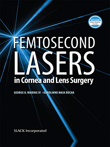 Femtosecond Lasers in Cornea and Lens Surgery (English Edition)