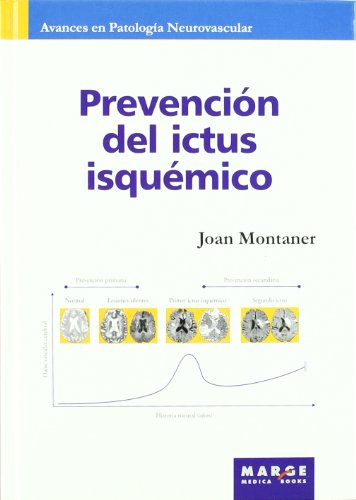 Prevención del ictus isquémico (Avances en patología neurovascular)